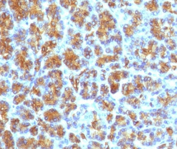IHC testing of human pancreas with recombinant CELA3B antibody (clone ELTS3B-4R). Required HIER: boi
