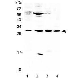 VEGFB Antibody / VEGF2