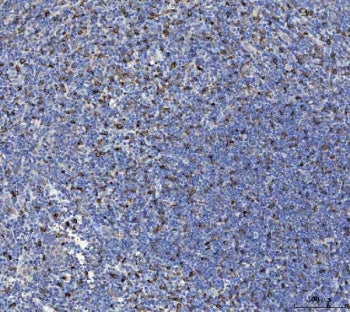 IHC staining of FFPE human tonsil tissue with Interleukin 10 antibody. HIER: boil tissue sections in