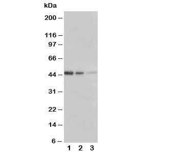 Western blot testing of ERBB3 antibody and Lane 1: Recombinant human protein 5ng; 2: 2.5ng; 3: 1.25n