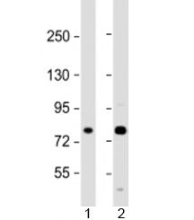 Western blot testing of human 1) A431 and 2) U-2OS cell lysate with MAN1A2 antibody at 1:2000. Predi