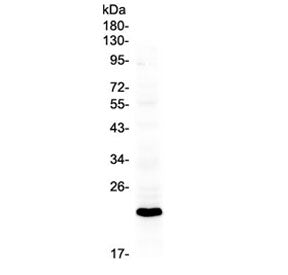 Western blot testing of mouse brain tissue with Bid antibody at 0.5ug/ml. Predicted molecular weight