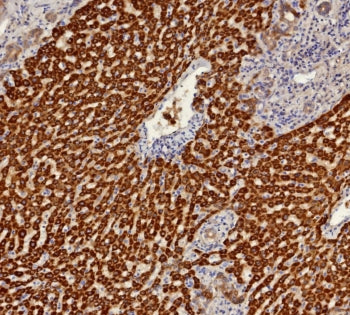 ARK1C1 Antibody / Aldo-keto Reductase Family 1 Member C1