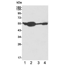 Western blot testing of 1) huma HCT116, 2) rat brain, 3) human K562 and 4) rat C6 cell lysates using