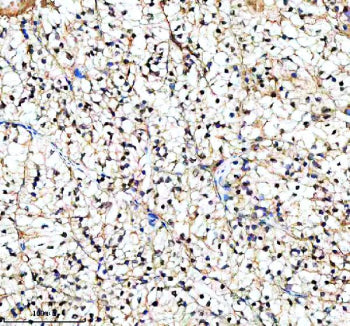 Immunohistochemical staining of PIF1 using anti-PIF1 antibody. PIF1 was detected in a paraffin-embed