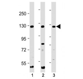 Western blot testing of INTS3 antibody at 1:2000 + Lane 1: human 293, 2: HeLa, and 3: Jurkat cell ly