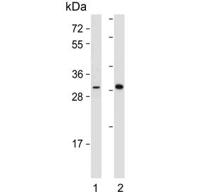 DIO2 Antibody