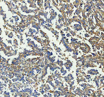 Immunohistochemical staining of GBP1 using anti-GBP1 antibody. GBP1 was detected in a paraffin-embed