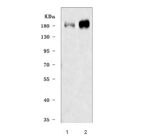 Western blot testing of human 1) HeLa and 2) SH-SY5Y cell lysate with Insulin receptor substrate 2 a