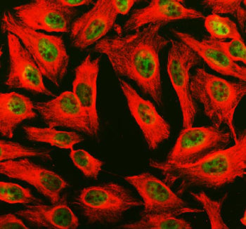Immunofluorescent staining of PHF8 using anti-PHF8 antibody (green) and anti-Beta Tubulin antibody (