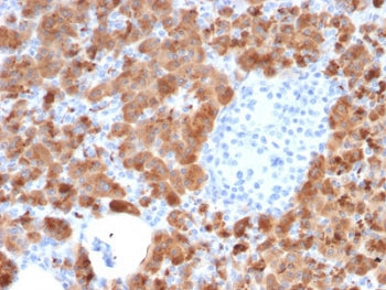 IHC testing of FFPE human pancreas with Carboxypeptidase A1 antibody (clone CPA1/2714). HIER: boil t