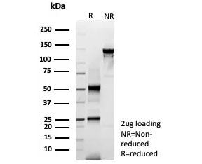 Keratin 6 Antibody / Cytokeratin 6