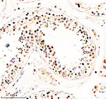 IHC analysis of TAF5 using anti-TAF5 antibody. TAF5 was detected in a paraffin-embedded section of h