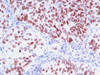 NKX2.1 Antibody Cocktail / TTF-1
