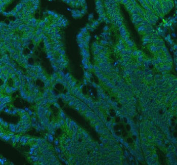 Immunofluorescent staining of FFPE human colon cancer tissue with SEC22B antibody (green) and DAPI n