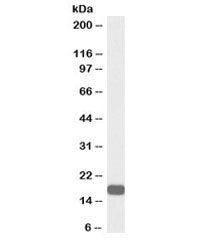 Western blot testing of human ovay lysate with biotinylated VHL antibody at 0.3ug/ml. Predicted mole