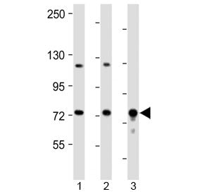 Western blot testing of 1) mouse kidney, 2) mouse lung and 3) rat lung tissue lysate with DLL4 antib