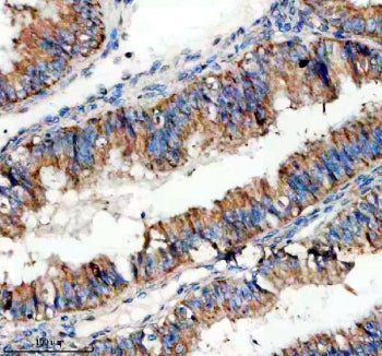 Immunohistochemical staining of SIGIRR using anti-SIGIRR antibody. SIGIRR was detected in a paraffin