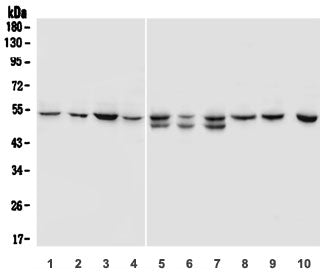 Western blot testing of human 1) A431, 2) HL-60, 3) K562, 4) ThP-1 and rat 5) spleen, 6) heart, 7) l