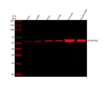 Western blot analysis of ATP6V1B2 using anti-ATP6V1B2 antibody. Lane 1: human Hela whole cell lysate
