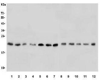Western blot testing of human 1) placenta, 2) U937, 3) HL60, 4) U-2 OS, 5) U-87 MG, 6) K562, 7) HeLa