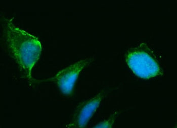 Immunofluorescent staining of FFPE human U-2 OS cells with HSD3B1 antibody (green) and DAPI nuclear