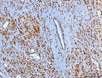 YY1 Antibody
