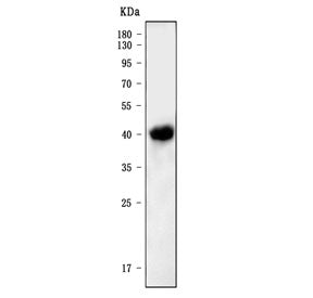 Western blot testing of mouse spleen tissue lysate with Nfkbie antibody. Expected molecular weight: