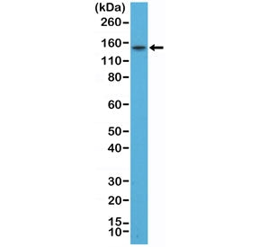 Western blot testing of human TT cell lysate with recombinant Thyroid Peroxidase antibody at 1:200.