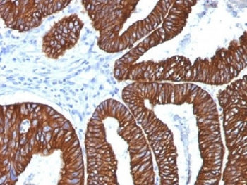 Cytokeratin 8/18 Antibody
