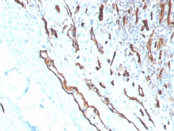 IHC staining of FFPE human tonsil with CD31 antibody (clone PECAM1/3530). HIER: boil tissue sections