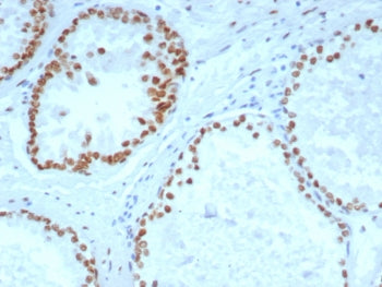 Androgen Receptor Antibody