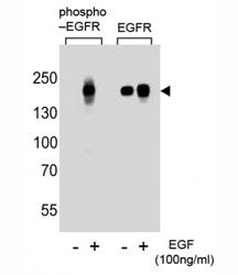 Phospho-EGFR Antibody (pS768)