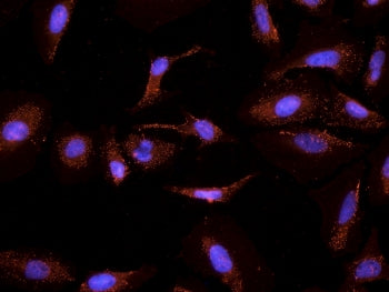 IHC testing of PFA-fixed and TX100-treated HeLa cells with CYP26A1 antibody at 2.5ug/ml (DAPI nuclea