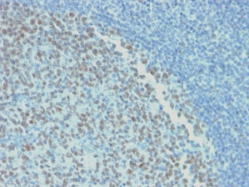 IHC testing of FFPE human tonsil with recombinant Bcl6 antibody (clone rBCL6/1718). Required HIER: b