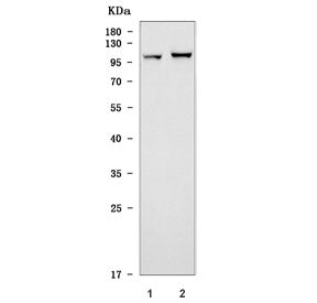 Western blot testing of 1) rat brain and 2) mouse brain tissue lysate with Toll-like receptor 5 anti