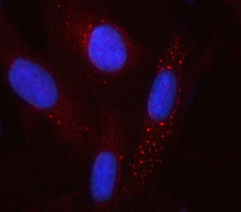 Immunofluorescent staining of FFPE human U-2 OS cells with GCM1 antibody (red) and DAPI nuclear stai