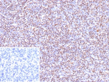 IHC staining of FFPE human tonsil tissue with recombinant Epstein-Barr Virus antibody (clone EBV/961