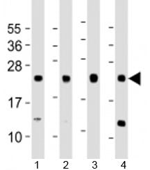 Western blot testing of human 1) A431, 2) HeLa, 3) HepG2 and 4) MCF-7 cell lysate with LITAF antibod