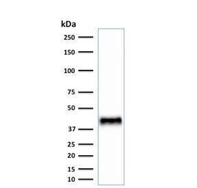 Western blot testing of mouse NIH3T3 cell lysate with BMI1 antibody. Predicted molecular weight: 37-