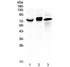 Western blot testing of 1) mouse thymus, 2) human HeLa and 3) human placenta lysate with ADAM17 anti