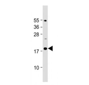 Western blot testing of IL-23 antibody at 1:2000 dilution + mouse pancreas lysate. Predicted molecul