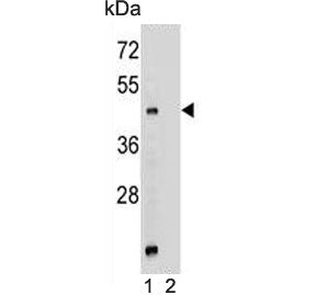 Western blot testing of mouse stomach lysate in the absence (1) and presence (2) of immunizing pepti