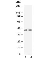 PSAT1 Antibody / Phosphoserine aminotransferase