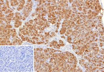IHC staining of FFPE human pancreas tissue with Colipase antibody (clone CLPS/9901). Inset: PBS used