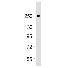 Western blot testing of human U-87 MG cell lysate with SCN1A antibody at 1:2000. Predicted molecular