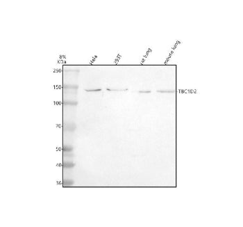 Western blot analysis of TBC1D1 using anti-TBC1D1 antibody. Electrophoresis was performed on a 8% SD