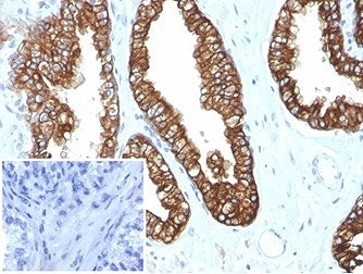 Cytokeratin 8/18 Antibody