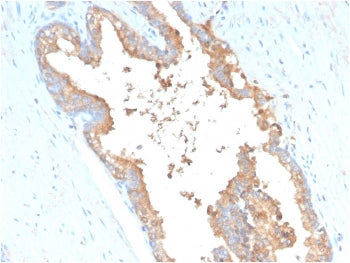 Transferrin Antibody
