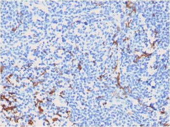 IHC testing of FFPE human tonsil with CD163 antibody (clone M130/2162). HIER: boil tissue sections i